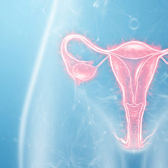 Endometriosis-3