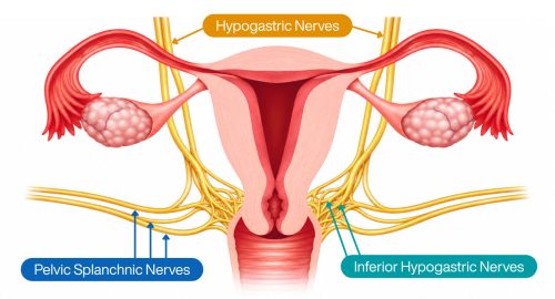 Nerve-Sparing Endometriosis Surgery: Protecting Pelvic Function