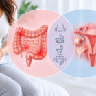 IBS and Endometriosis: Understanding the Overlap in Symptoms