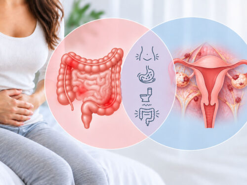 IBS and Endometriosis: Understanding the Overlap in Symptoms