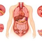 Endometriosis in Other Organs: Symptoms and Complications