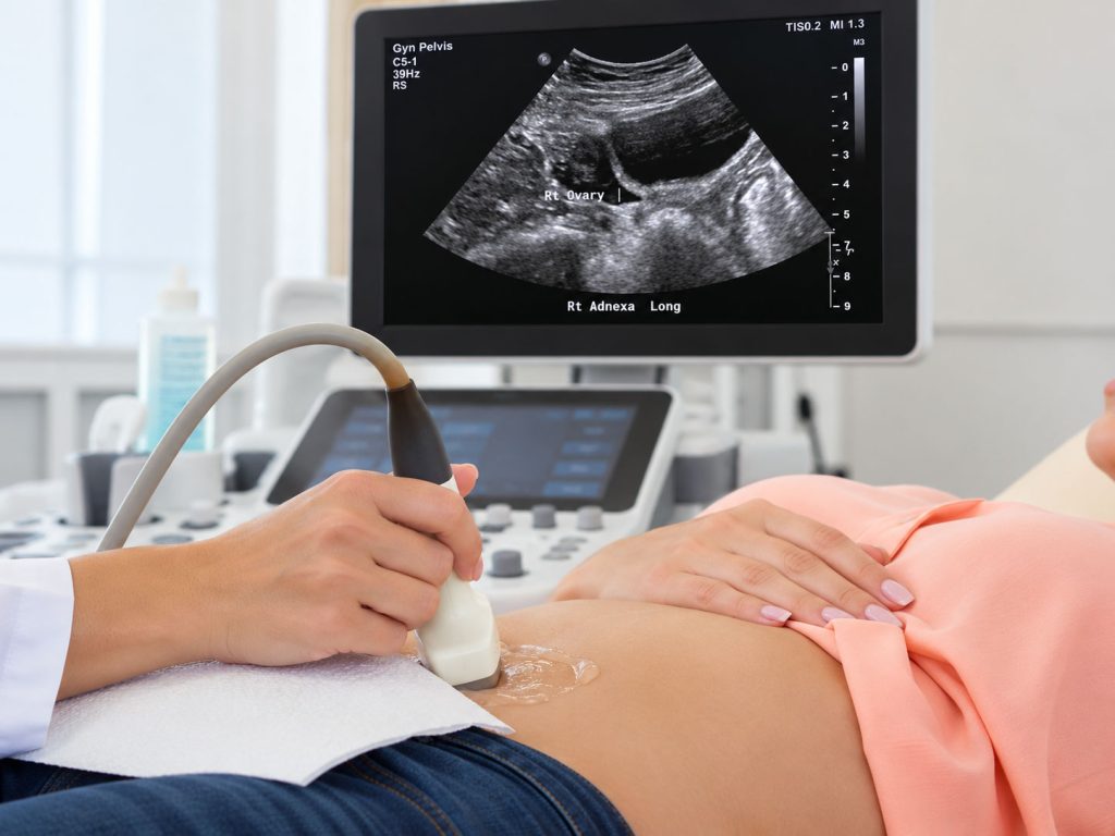 Woman undergoing a pelvic ultrasound examination while a monitor displays an ultrasound image of the right ovary.