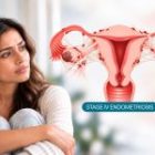 Getting Pregnant Naturally With Stage 4 Endometriosis